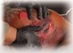 North American Rescue HyFin Chest Seal 19 North American Rescue HyFin Chest Seal -Outdoor Life Store north american rescue hyfin chest seal 10 0015 01100.1683217981