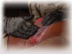 North American Rescue HyFin Chest Seal 21 North American Rescue HyFin Chest Seal -Outdoor Life Store north american rescue hyfin chest seal 10 0015 38955.1683217981