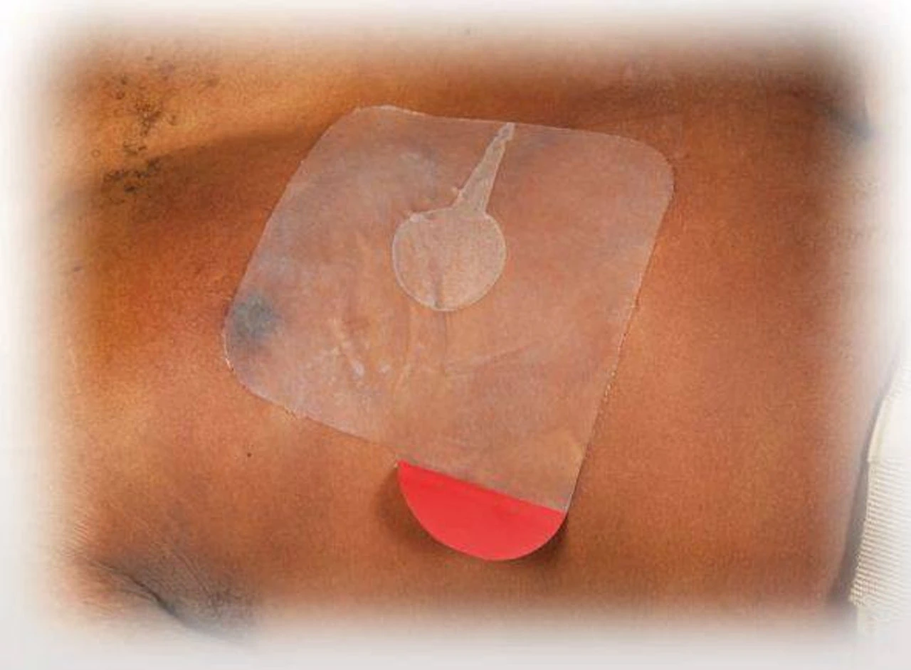 North American Rescue HyFin Vent Chest Seal 14 North American Rescue HyFin Vent Chest Seal - Image 12